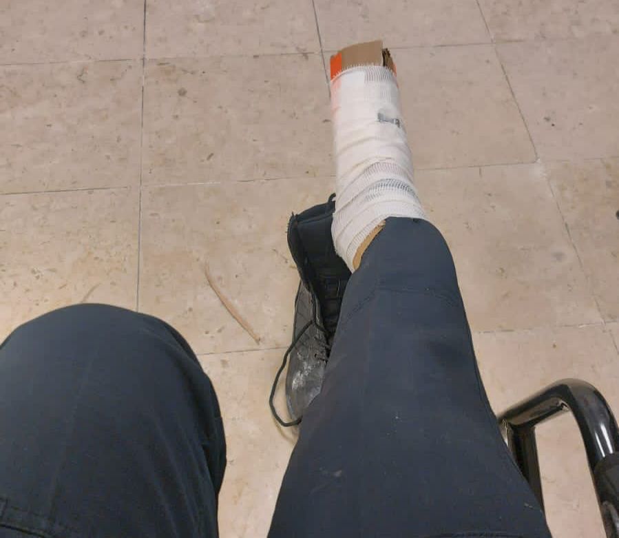 Mujeres Policías Lesionadas durante manifestaciones del 8M