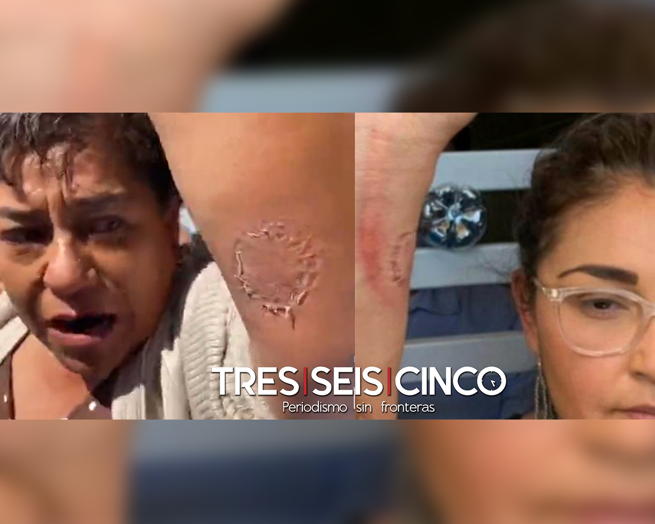 ¡Usted me mordió!